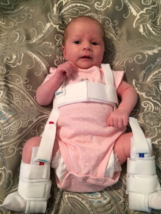 baby leg harness